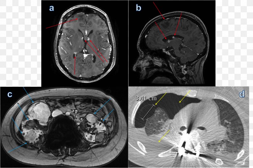 Computed Tomography Radiology Organism Brain, PNG, 1360x906px, Computed Tomography, Brain, Medical, Medical Equipment, Medical Imaging Download Free