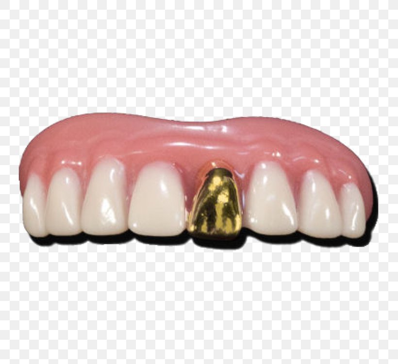 Human Tooth Gold Teeth Dentures, PNG, 750x750px, Tooth, Blingbling, Crown, Deciduous Teeth, Dentistry Download Free
