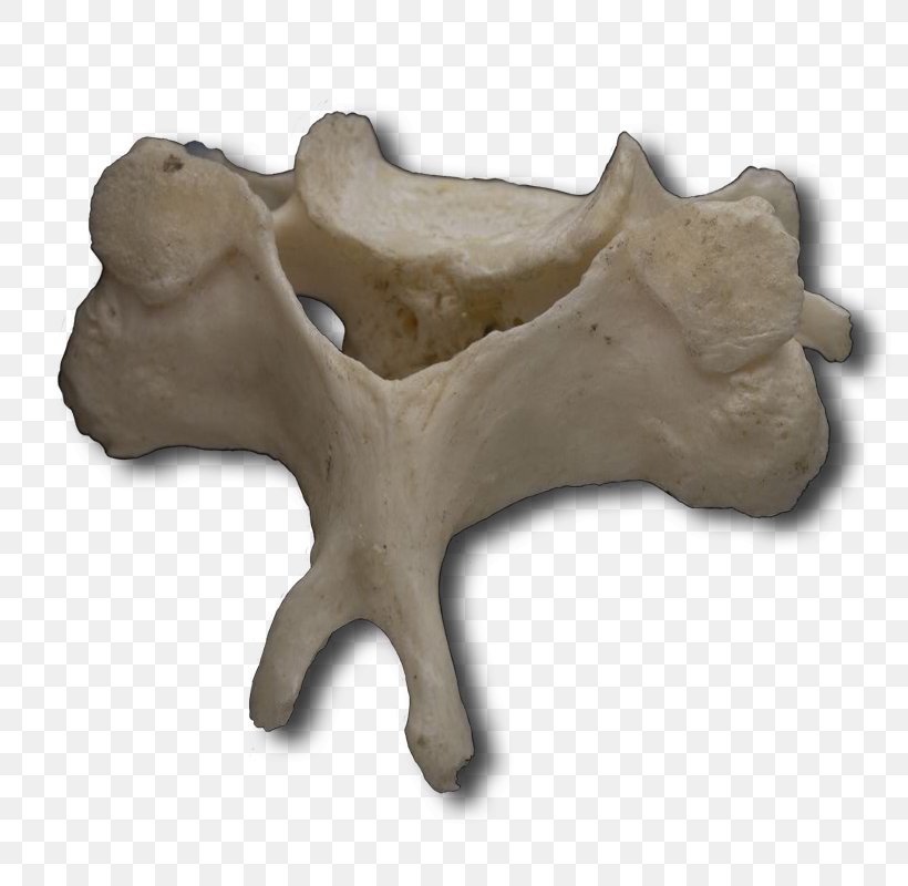 Human Vertebral Column Atlas Cervical Vertebrae, PNG, 800x800px, Vertebral Column, Anatomy, Articular Processes, Artifact, Atlas Download Free