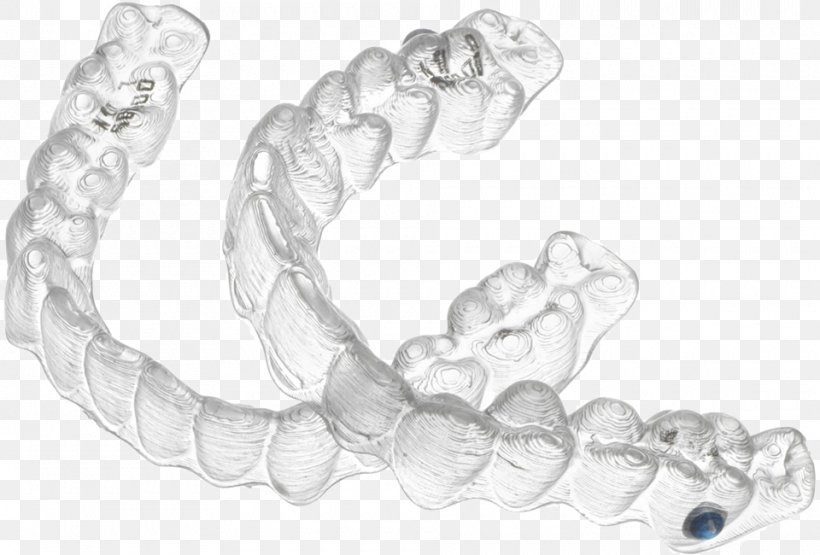 Clear Aligners Contemporary Orthodontics Dentistry Dental Braces, PNG, 960x650px, Clear Aligners, Black And White, Body Jewelry, Bracelet, Chain Download Free