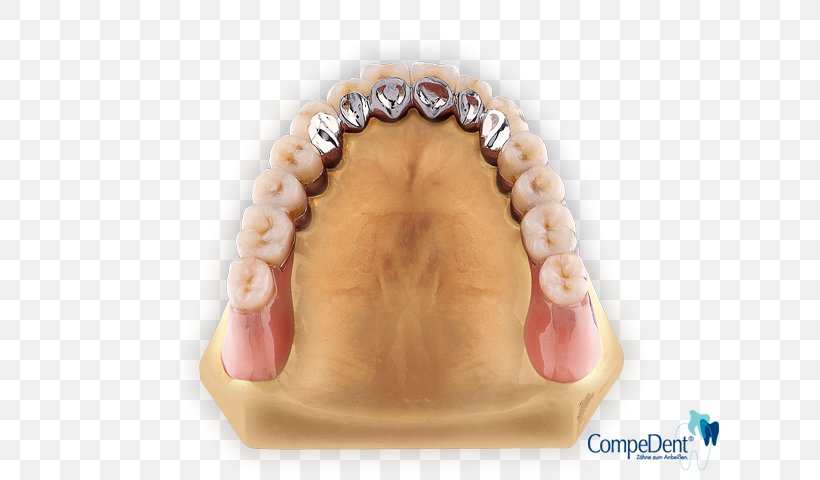 Tooth Dental Laboratory Dentures Removable Partial Denture Dentallabor Klein GmbH, PNG, 640x480px, Tooth, Chin, Dental Laboratory, Dentures, Finger Download Free