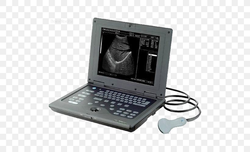 Ultrasonography Medicine Ultrasound Image Scanner Medical Diagnosis, PNG, 500x500px, Ultrasonography, Artikel, Computer Hardware, Computer Monitor Accessory, Digital Data Download Free