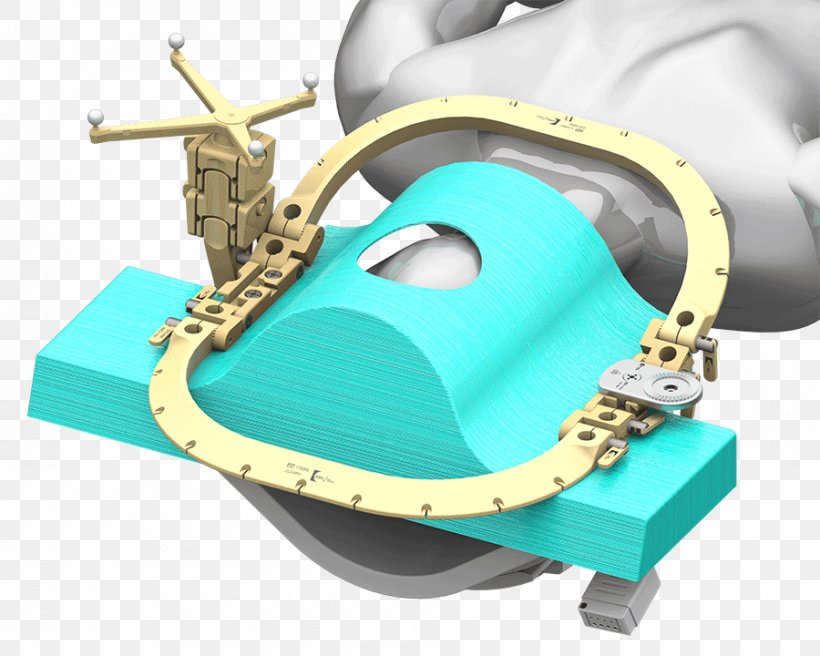 Neurosurgery Magnetic Resonance Imaging Brainlab Intraoperative MRI Craniotomy, PNG, 900x720px, Neurosurgery, Biopsy, Brainlab, Craniotomy, Electric Blue Download Free
