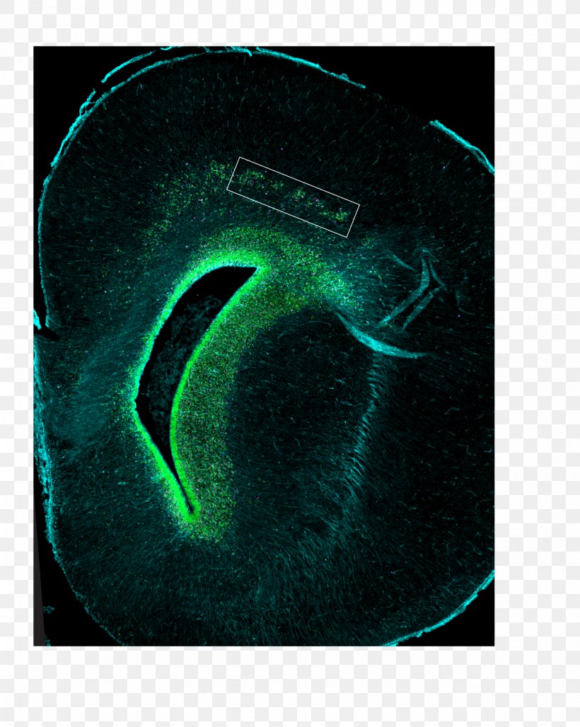 Brain Size Human Brain Allen Institute For Brain Science Cerebral Cortex, PNG, 1732x2172px, Brain, Allen Institute For Brain Science, Aqua, Brain Implant, Brain Size Download Free