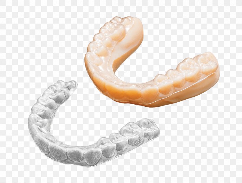 Jaw Human Tooth Bergamo Accessori Srl Dentistry, PNG, 1200x909px, 3d Printing, Jaw, Anatomy, Body Jewellery, Body Jewelry Download Free