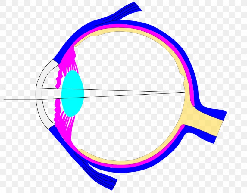 Lens Ray Human Eye Iris, PNG, 981x768px, Lens, Cataract, Contact Lenses, Dioptre, Eye Download Free