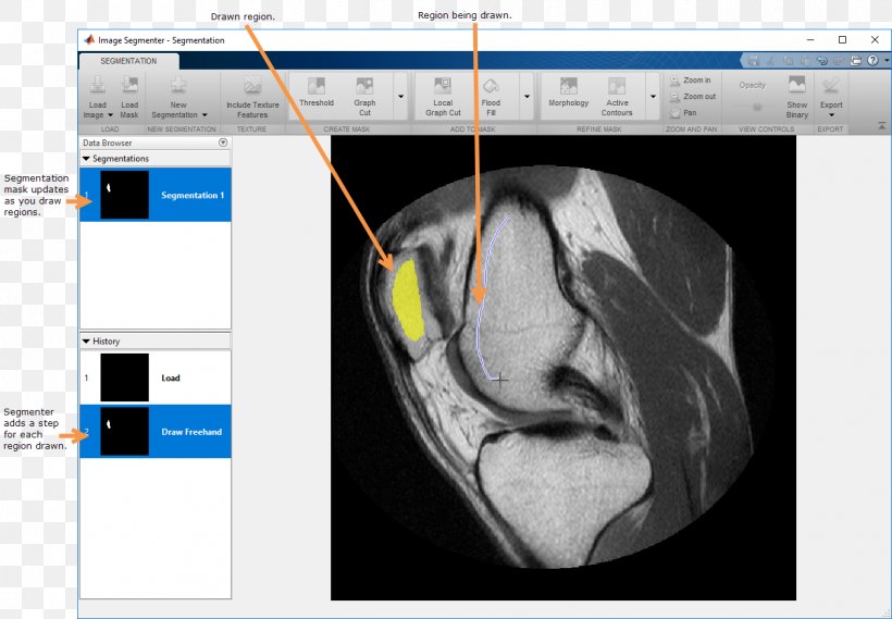 Image Segmentation Thresholding MATLAB Binary Image, PNG, 1259x874px, Image Segmentation, Binary Image, Chart, Digital Image Processing, Grayscale Download Free