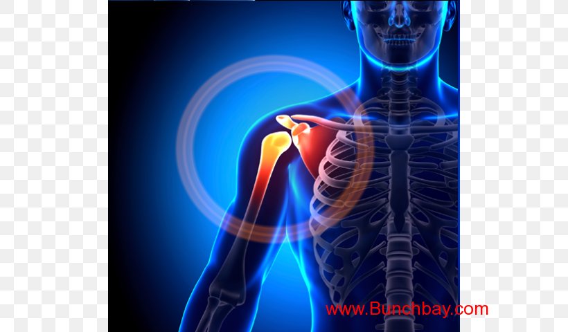 Shoulder Pain Shoulder Joint Impingement Syndrome Injury, PNG, 640x480px, Shoulder Pain, Bottle, Bursitis, Dislocated Shoulder, Electric Blue Download Free