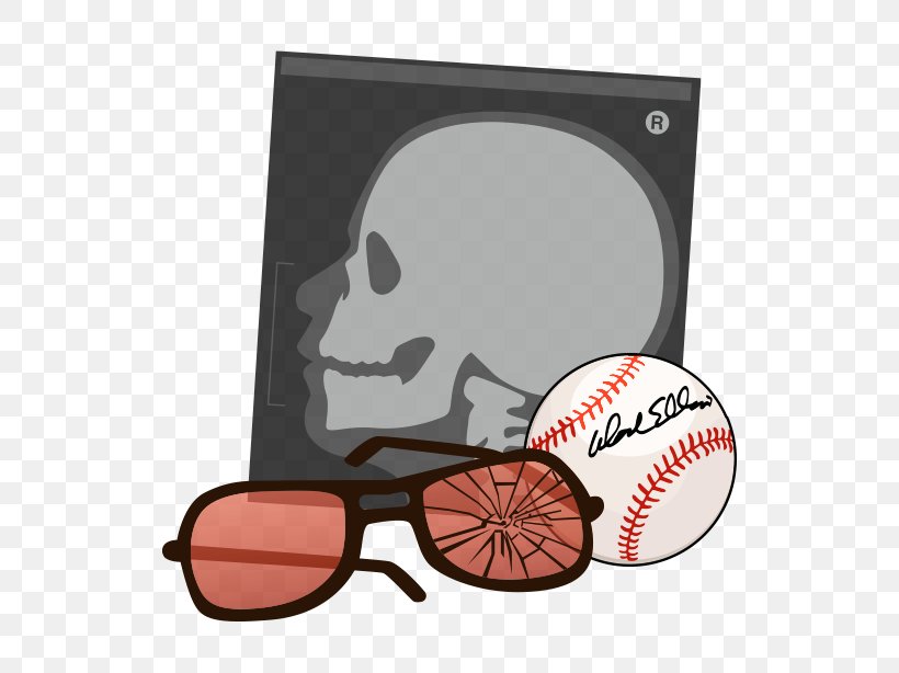 Goggles Baltimore Glasses Product Design Baseball, PNG, 650x614px, Goggles, Baltimore, Baseball, Baseball Card, Brand Download Free
