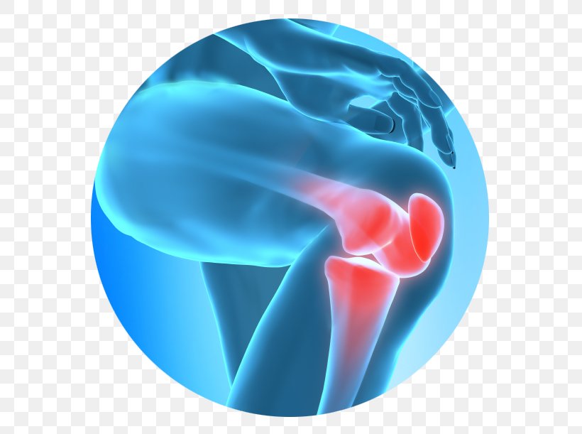 Knee Pain Injury Therapy Pain Management, PNG, 586x611px, Knee Pain, Aqua, Blue, Electric Blue, Health Download Free