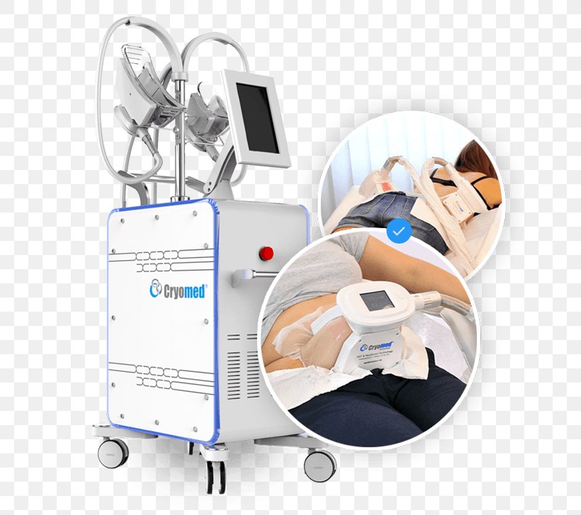 Cryolipolysis Fat Skin Frostbite Cryomed Swiss, PNG, 700x727px, Cryolipolysis, Adipose Tissue, Cold, Fat, Frostbite Download Free
