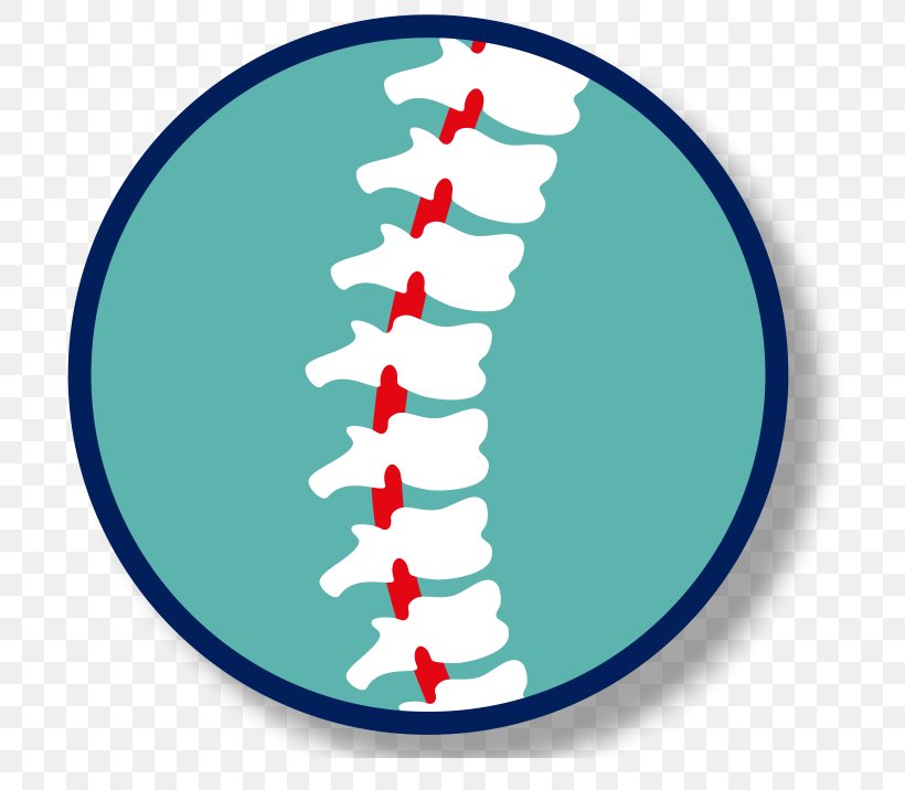 Spinal Cord Injury Clip Art Health Spinal Manipulation, PNG, 743x716px, Spinal Cord, Chiropractic, Christmas, Christmas Decoration, Christmas Tree Download Free