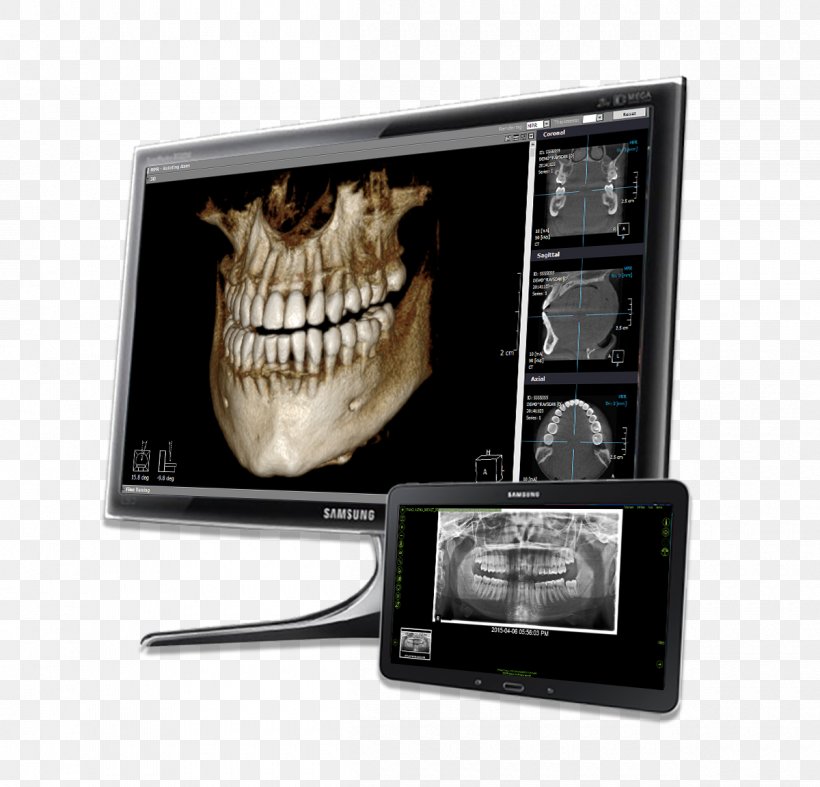 Dentistry Computer Software VELscope Visualization Medical Diagnosis, PNG, 1200x1152px, Dentistry, Cancer, Carestream Health, Computer Software, Dental Software Download Free