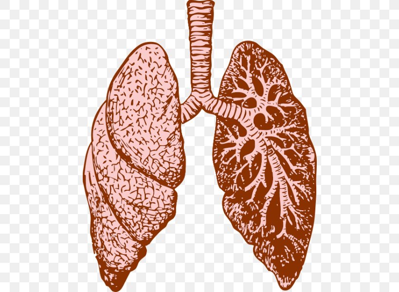Lung Cystic Fibrosis Chronic Obstructive Pulmonary Disease Breathing, PNG, 800x600px, Lung, Breathing, Butterfly, Computed Tomography Angiography, Cystic Fibrosis Download Free