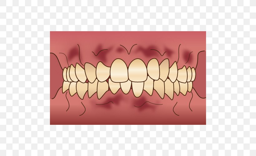 Tooth 審美歯科 Dentist Gums, PNG, 500x500px, Watercolor, Cartoon, Flower, Frame, Heart Download Free