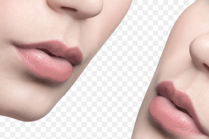 Lip Balm Mouth Face, PNG, 1200x801px, Lip Balm, Beauty, Cheek, Chin, Close Up Download Free
