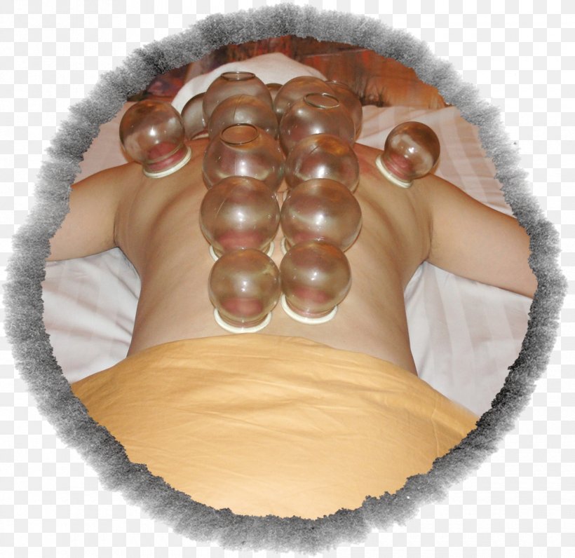 Cupping Therapy Health Running Fitness, PNG, 1220x1185px, Cupping Therapy, Arm, Culture, Finger, Google Images Download Free