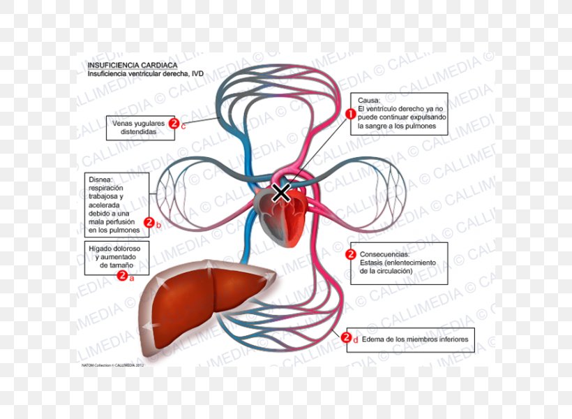 Heart Failure Systole Cardiology Symptom Ventricle, PNG, 600x600px, Watercolor, Cartoon, Flower, Frame, Heart Download Free