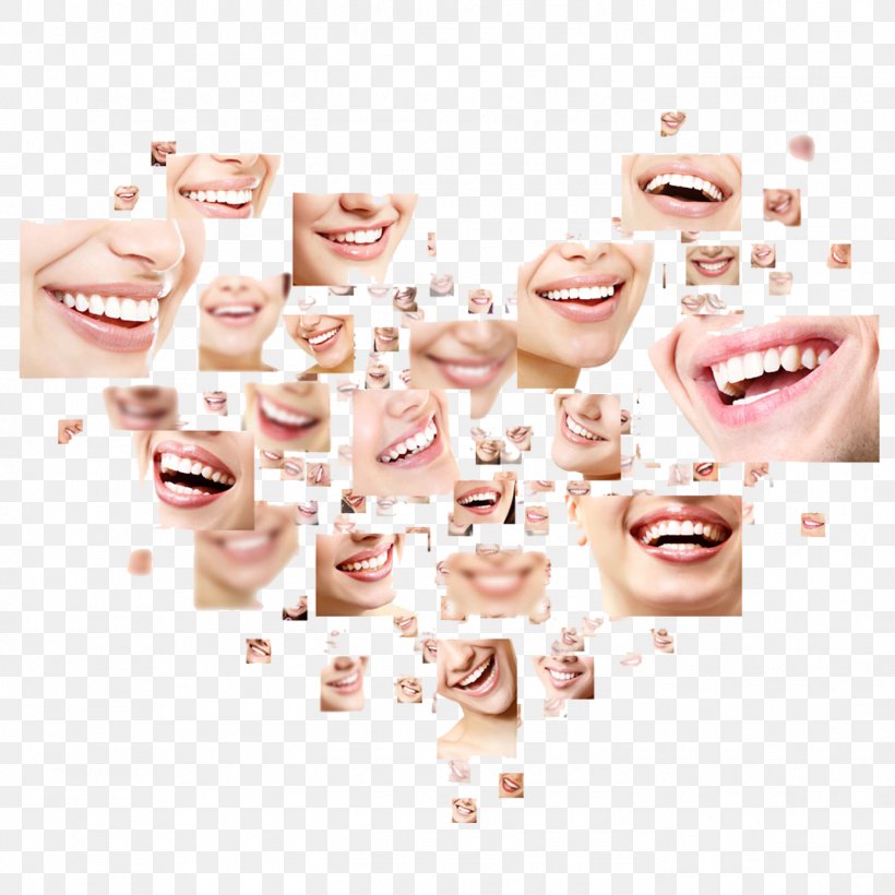 Dentistry Human Tooth Health Smile, PNG, 1392x1392px, Dentistry, Cheek, Chin, Cosmetic Dentistry, Dental Braces Download Free