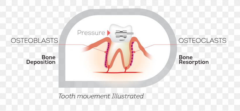 Orthodontics Jaw Tooth Therapy Brand, PNG, 2072x965px, Watercolor, Cartoon, Flower, Frame, Heart Download Free