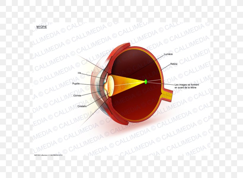 Far-sightedness Ophthalmology Presbyopia Macular Degeneration Eye, PNG, 600x600px, Farsightedness, Degeneration, Eye, Eyewear, Glasses Download Free