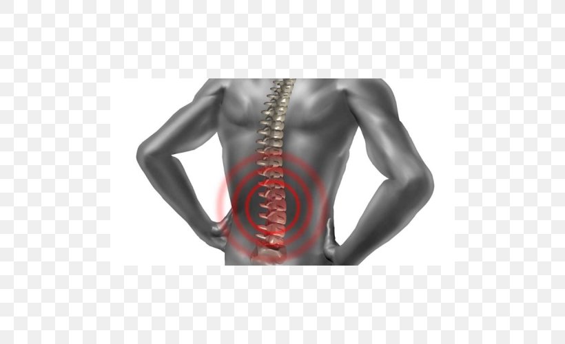 Back Pain Physical Therapy Vertebral Column Acupuncture Human Back, PNG, 500x500px, Back Pain, Abdomen, Active Undergarment, Acupuncture, Arm Download Free