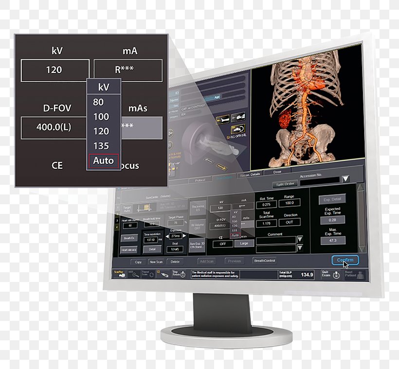 Computer Monitors Canon Medical Systems Corporation Toshiba Computed Tomography Image Scanner, PNG, 800x759px, Computer Monitors, Canon, Canon Medical Systems Corporation, Computed Tomography, Computer Download Free