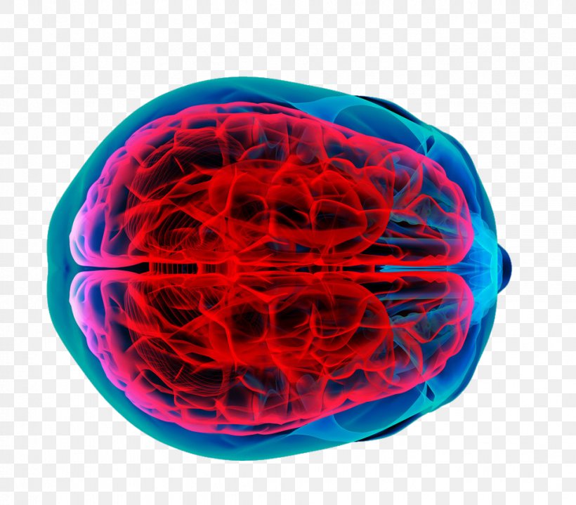 Brain Tumor Human Brain Brain Mapping Cancer, PNG, 976x856px, Brain, Benign Tumor, Brain Mapping, Brain Tumor, Cancer Download Free