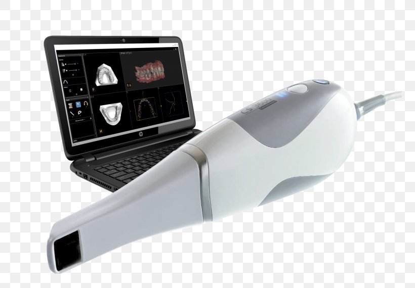 Image Scanner Digital Radiography 3D Scanner Escáner, PNG, 768x570px, 3d Scanner, Image Scanner, Carestream Health, Cephalometry, Computeraided Design Download Free