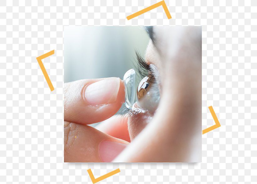 Optometry Contact Lenses Eye Examination Eye Care Professional, PNG, 590x587px, Optometry, Contact Lenses, Dry Eye Syndrome, Ear, Eye Download Free