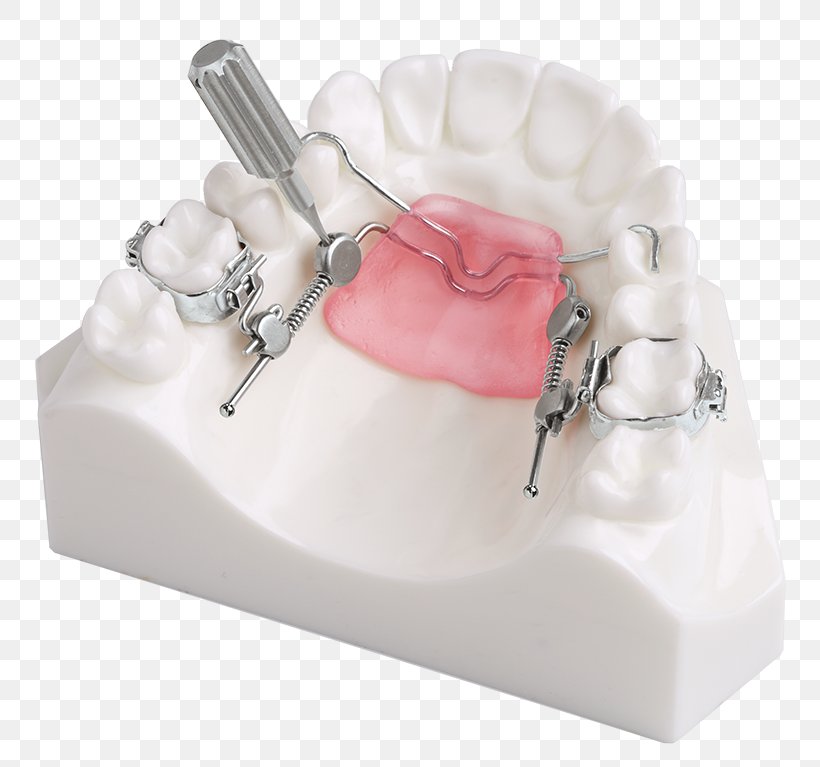 DynaFlex Orthodontics International Plaza Court Orthodontic Technology, PNG, 800x767px, Dynaflex, Blog, Copyright, Dental Braces, Home Appliance Download Free