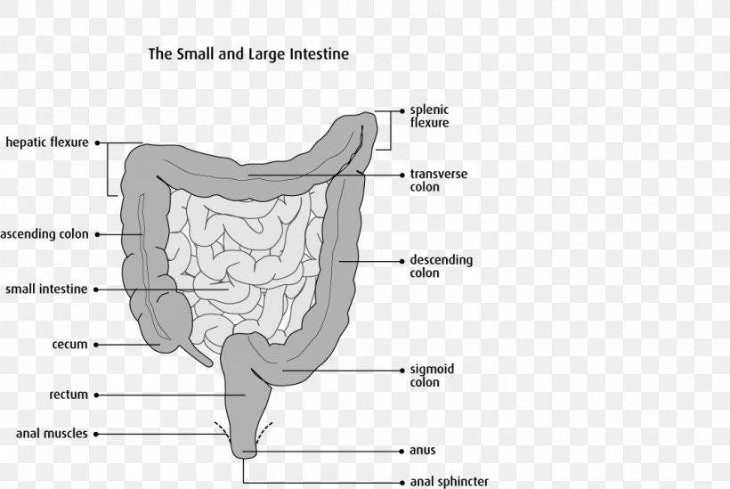 Colectomy Bowel Resection Large Intestine Surgery Sigmoid Colon, PNG, 1062x712px, Watercolor, Cartoon, Flower, Frame, Heart Download Free