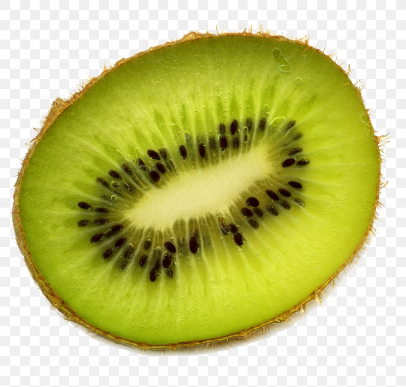 Kiwifruit Clip Art, PNG, 1000x955px, Kiwifruit, Food, Fruit, Health, Image Resolution Download Free