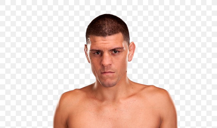 Nick Diaz UFC 158: St-Pierre Vs. Diaz Mixed Martial Arts Boxing Strikeforce, PNG, 720x486px, Nick Diaz, Arm, Boxing, Cheek, Chin Download Free