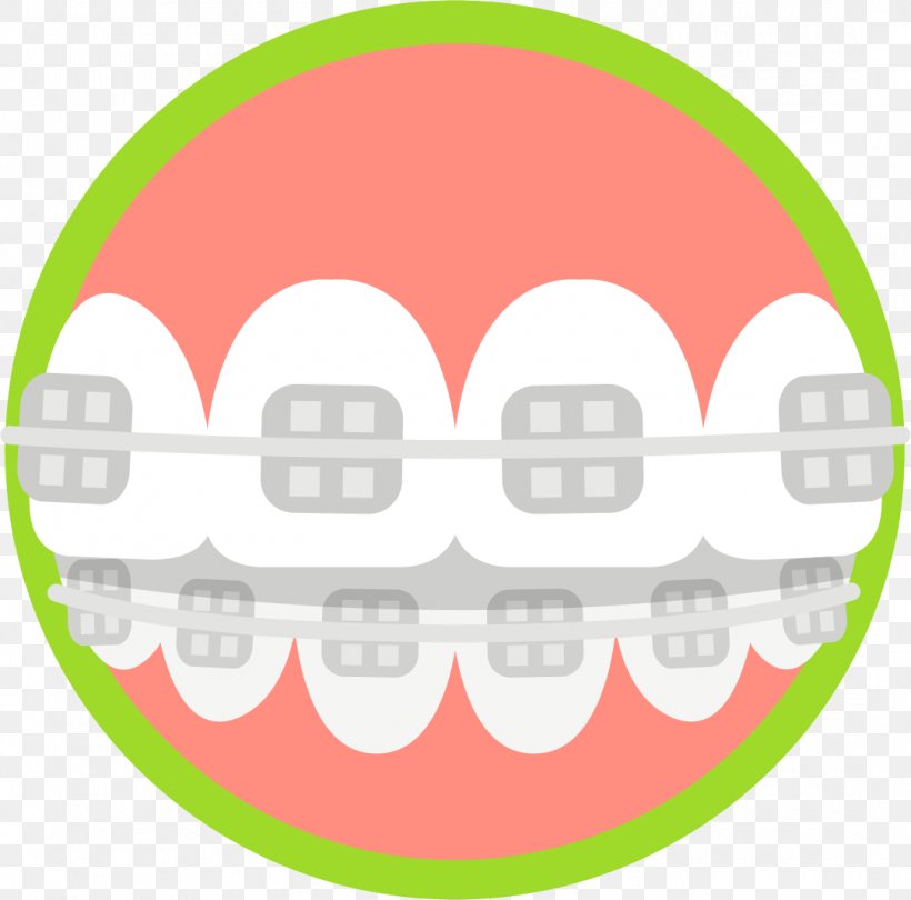 Cosmetic Dentistry Tooth Health Orthodontics, PNG, 1080x1068px, Dentistry, Area, Clear Aligners, Cosmetic Dentistry, Dental Braces Download Free