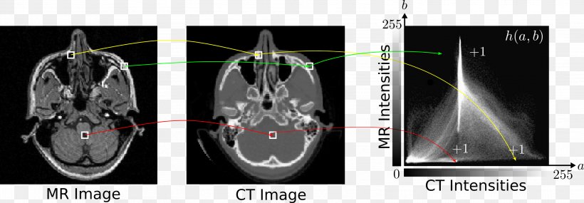 Medical Imaging Radiology Technology X-ray, PNG, 3132x1090px, Medical Imaging, Magnetic Resonance Imaging, Medical, Medicine, Multimedia Download Free