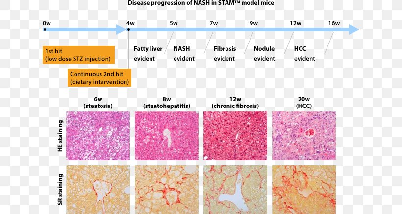 Non-alcoholic Fatty Liver Disease Computer Mouse Model Fatty Degeneration, PNG, 646x438px, Nonalcoholic Fatty Liver Disease, Area, Computer Mouse, Dietinduced Obesity Model, Fibrosis Download Free