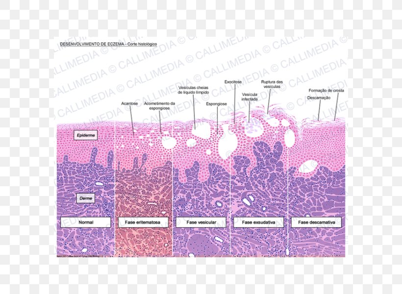 Histology Dermatitis Keratinocyte Microscope Slides Corte Histológico, PNG, 600x600px, Histology, Area, Biology, Brand, Cell Download Free
