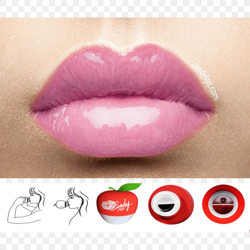 Lip Augmentation Beauty And The Peach Face Surgery, PNG, 1000x1000px, Lip, Beauty And The Peach, Cosmetics, Face, Health Beauty Download Free