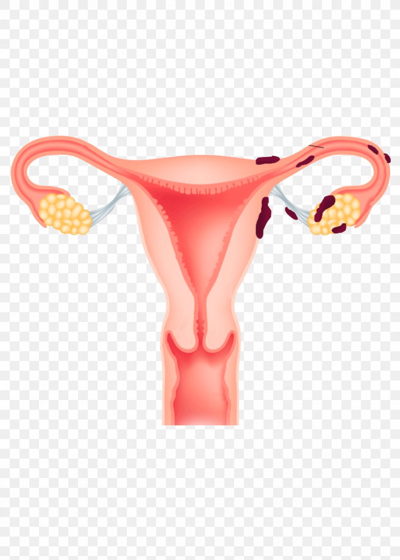 Endometrium Endometriosis Uterus Menstruation Ovary, PNG, 912x1277px, Watercolor, Cartoon, Flower, Frame, Heart Download Free