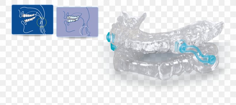 Snoring Dentistry Apnea Upper Airway Resistance Syndrome, PNG, 1000x448px, Snoring, Animal Figure, Apnea, Blue, Body Jewelry Download Free