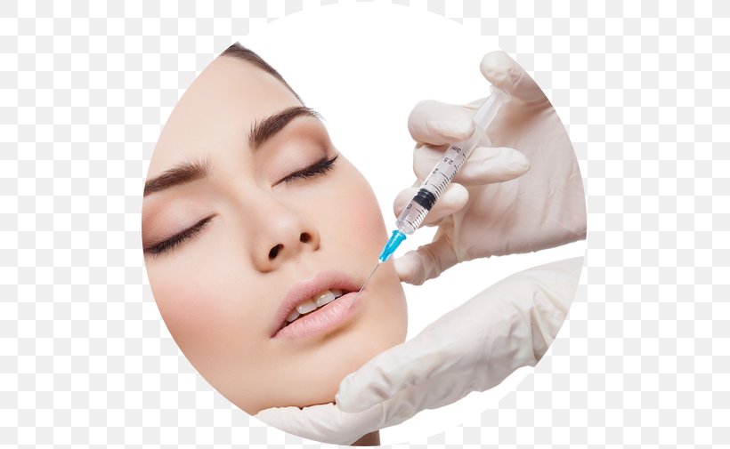 Injection Lip Surgery Skin Adverse Effect, PNG, 505x505px, Injection, Adverse Effect, Baby Bottle, Beauty, Cheek Download Free