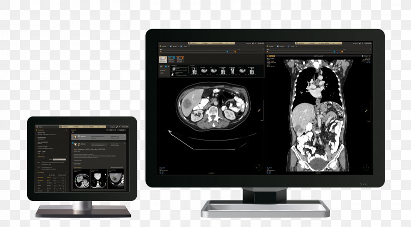Picture Archiving And Communication System Philips Radiology Template Electronics, PNG, 6312x3498px, Philips, Brand, Computer Software, Display Device, Electrical Wires Cable Download Free