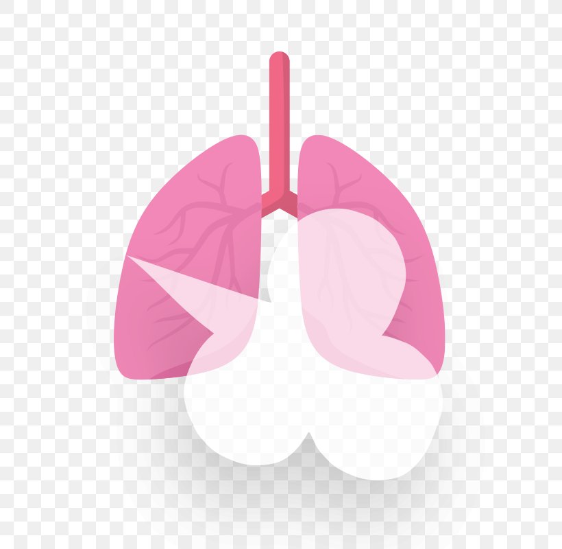 Chronic Obstructive Pulmonary Disease Obstructive Lung Disease Chronic Condition Bronchitis, PNG, 600x800px, Obstructive Lung Disease, Bronchitis, Chronic Condition, Disease, Lung Download Free