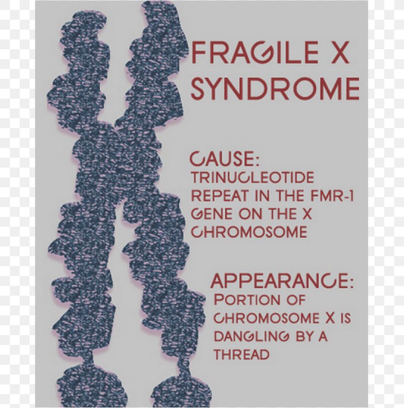 Fragile X Syndrome Intellectual Disability Genetic Disorder 22q13 Deletion Syndrome, PNG, 739x828px, Fragile X Syndrome, Autism, Chromosome, Disability, Disease Download Free
