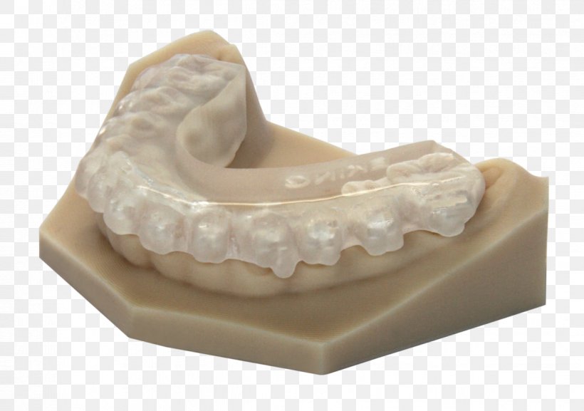 3D Printing EnvisionTEC Industry, PNG, 1222x860px, 3d Printing, Dentist, Dentistry, Dentures, Envisiontec Download Free
