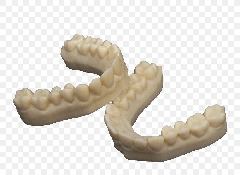 3D Printing Dentistry Dental Composite Crown, PNG, 800x600px, 3d Printing, Acrylonitrile Butadiene Styrene, Crown, Dental Composite, Dental Impression Download Free