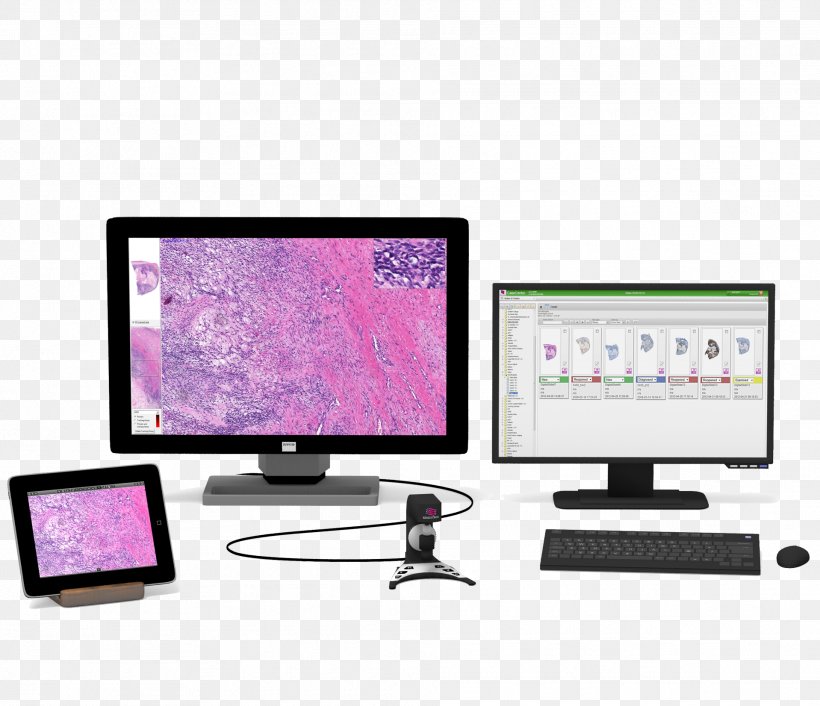 Computer Monitors Digital Pathology Digital Data, PNG, 1918x1652px, Computer Monitors, Computer, Computer Monitor, Computer Monitor Accessory, Digital Data Download Free