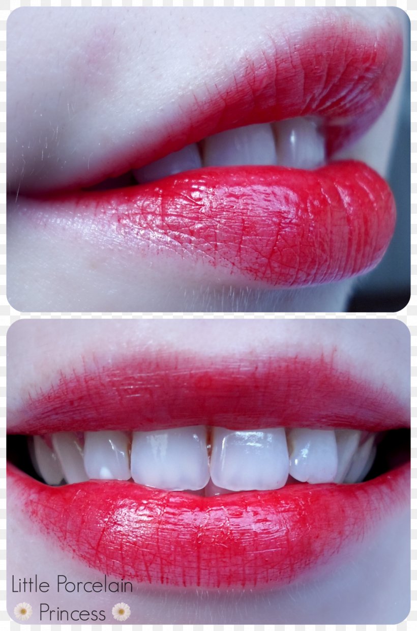 Lip Gloss Lip Stain Lipstick Oil, PNG, 1058x1600px, Lip, Blood, Close Up, Cosmetics, Jaw Download Free