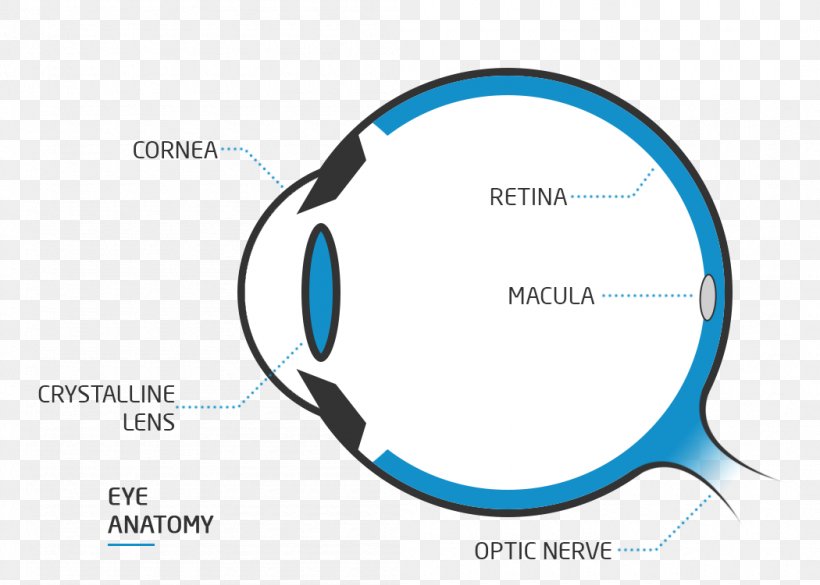 Floater Eye Nd:YAG Laser Visual Perception Far-sightedness, PNG, 1050x750px, Floater, Astigmatism, Binocular Vision, Blue, Blurred Vision Download Free